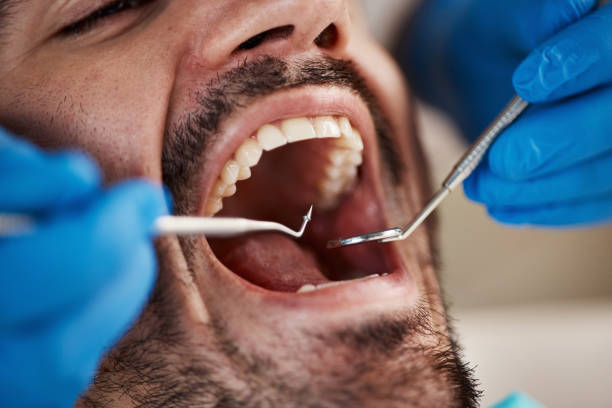 Best Tooth Infection Emergency Dentist  in Quitman, GA