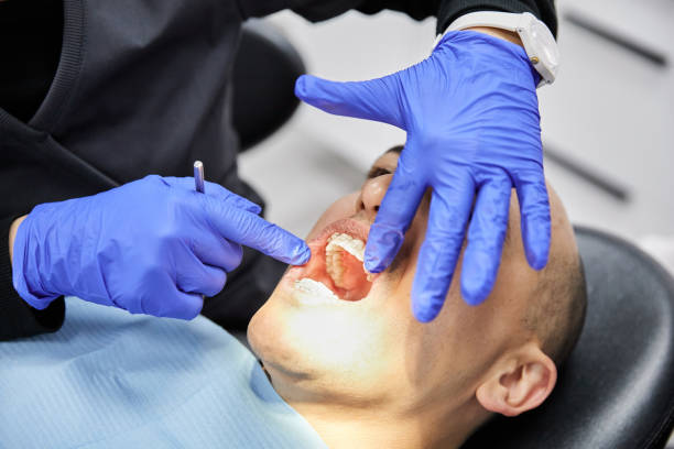 Best Emergency Dental Filling Replacement  in Quitman, GA
