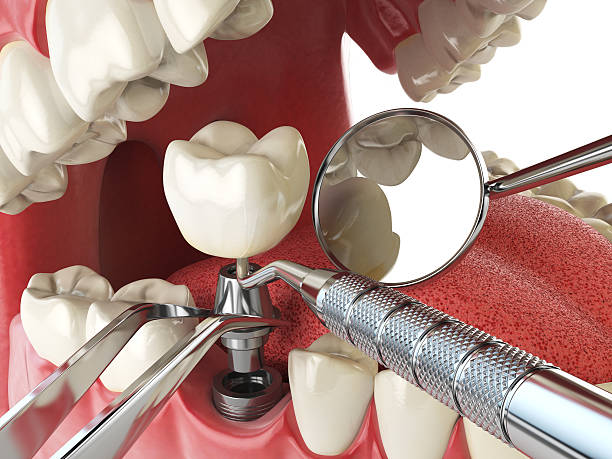 Best Emergency Gum Pain Relief  in Quitman, GA