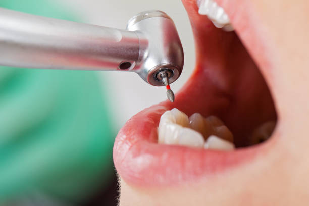 Best Knocked-Out Tooth Emergency  in Quitman, GA